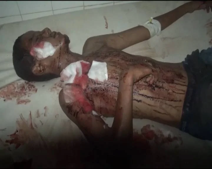 Man 8 - AlMocha, Yemen - 24 July 2015.jpg
