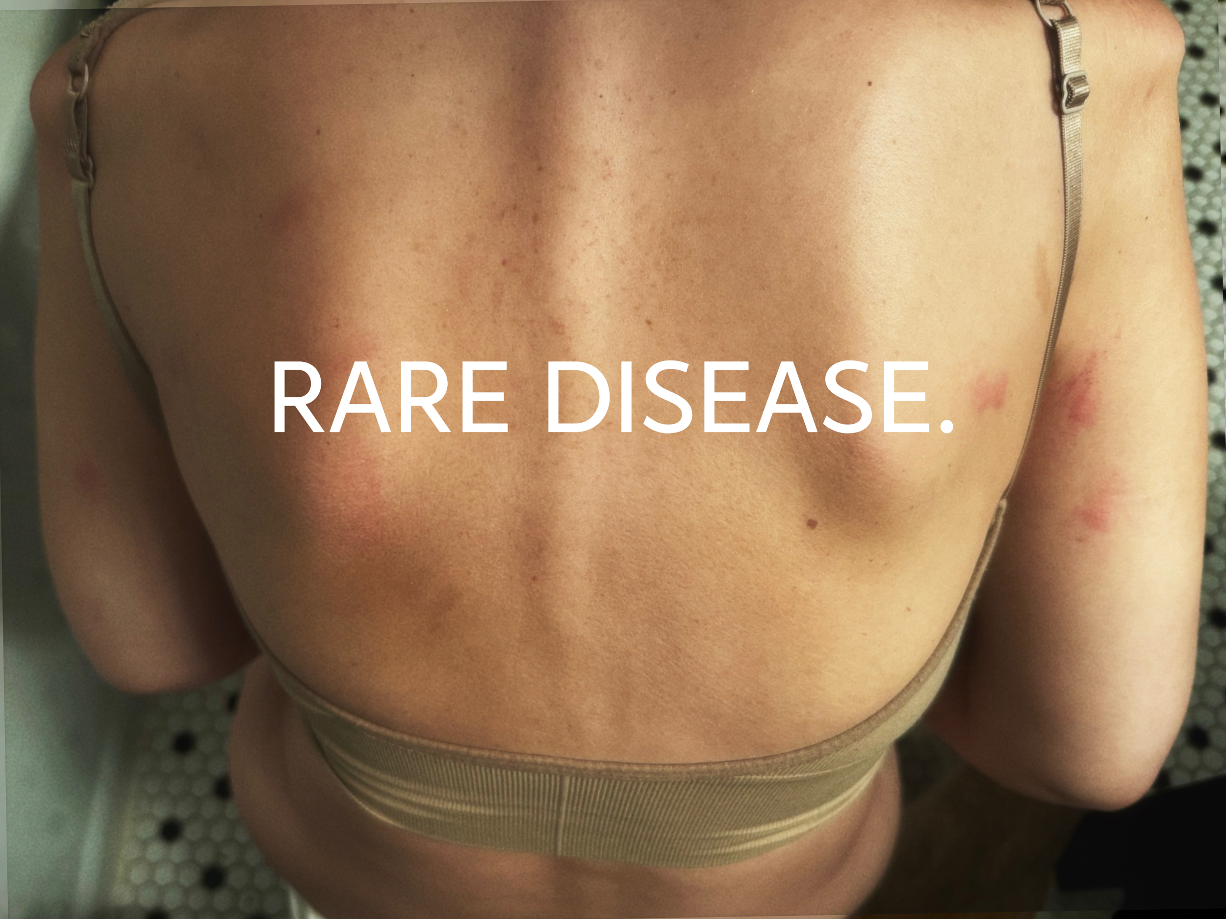 Rare Disease Day - Please Don’t Leave Me