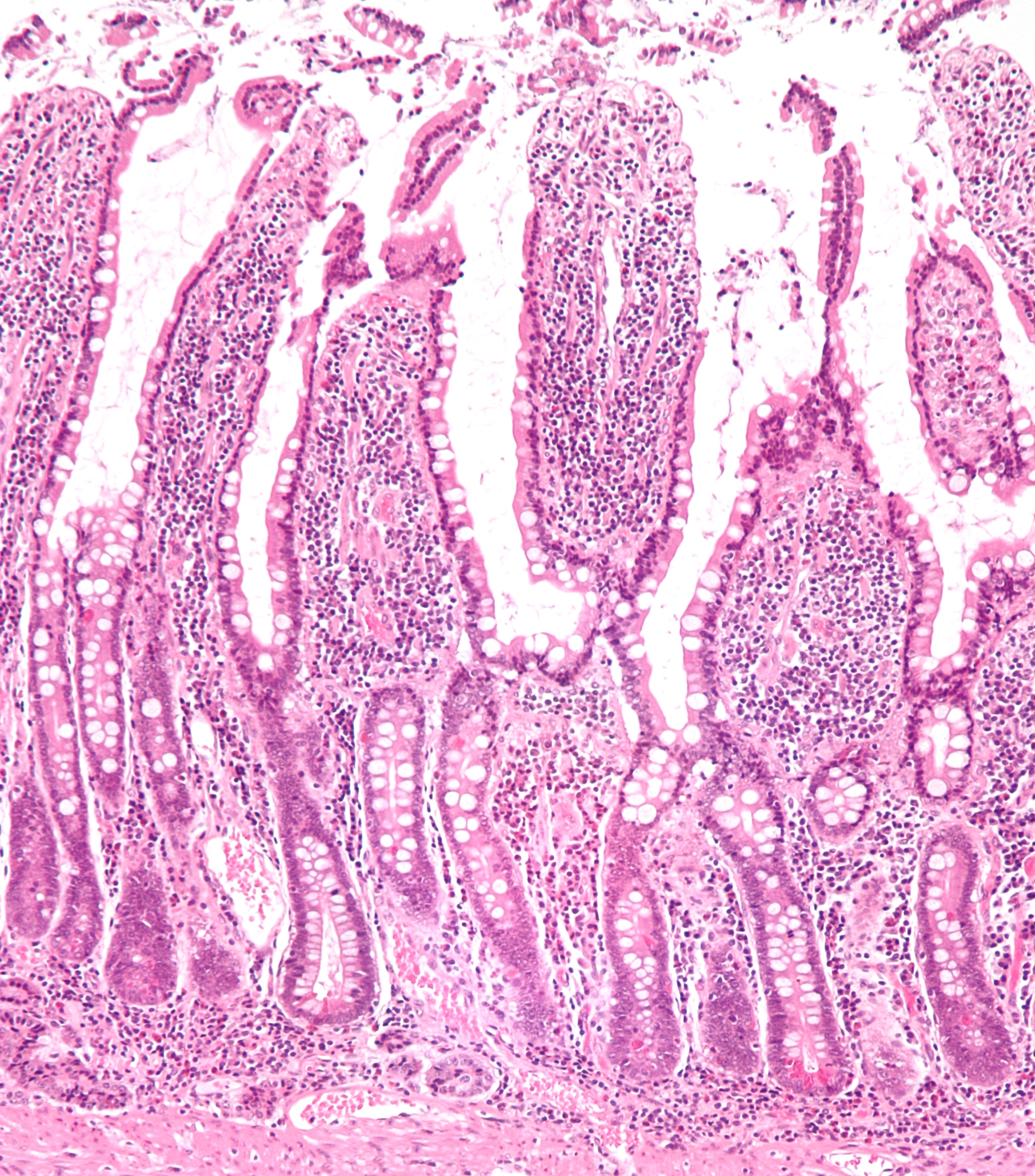 Home is where the heart is. And for our microbial species — the intestines are home. Here are 'villi', the intestines' finger-like projections lining our inside skin. Image: Wikimedia Commons/CC BY-SA 3.0.