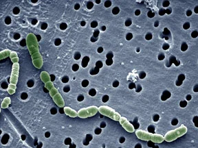 Lactic acid bacteria Oenococcus turning tricks with grapes, fermenting acids and being vital to the production of wine 'n that. Image: Public Domain.