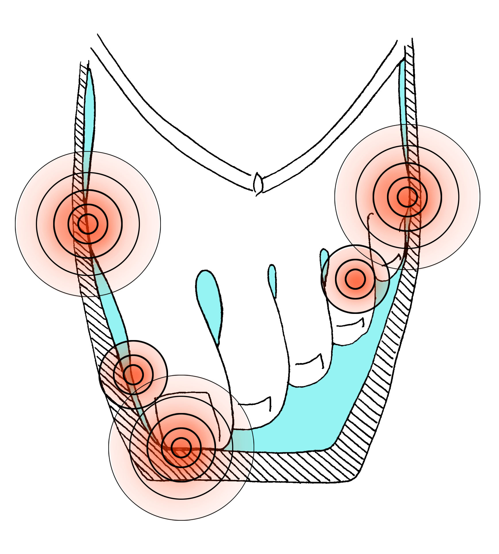 the Problem — PerfectFit Pointe