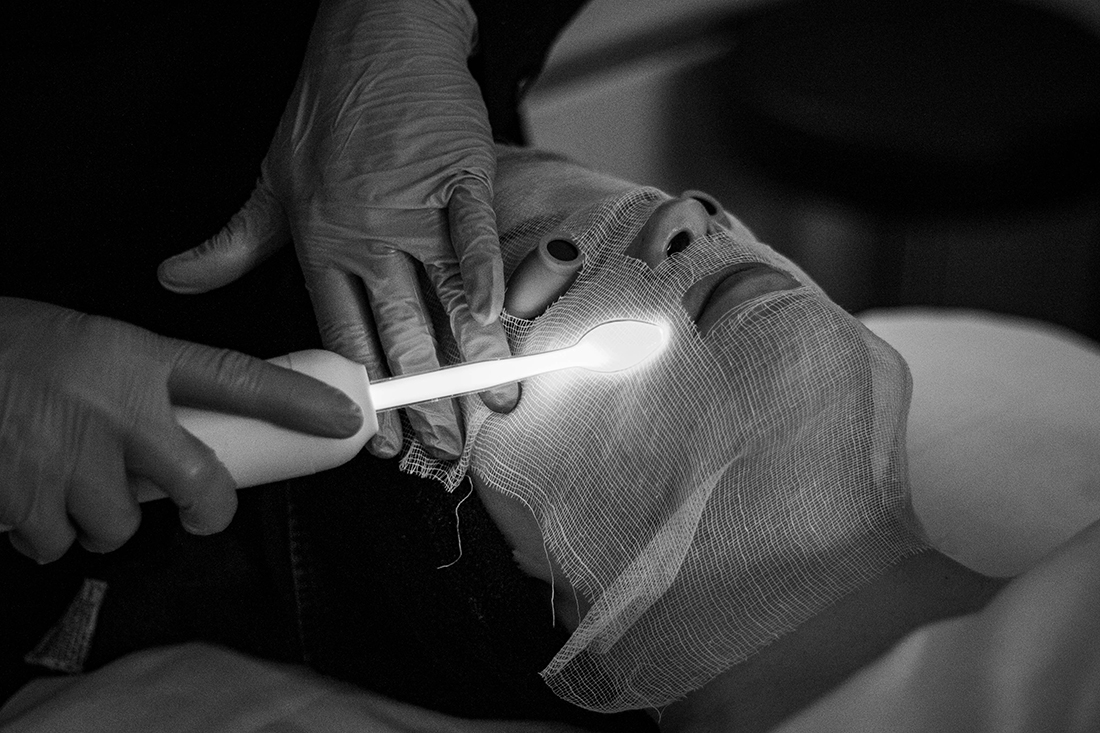 HF facial 4.jpg