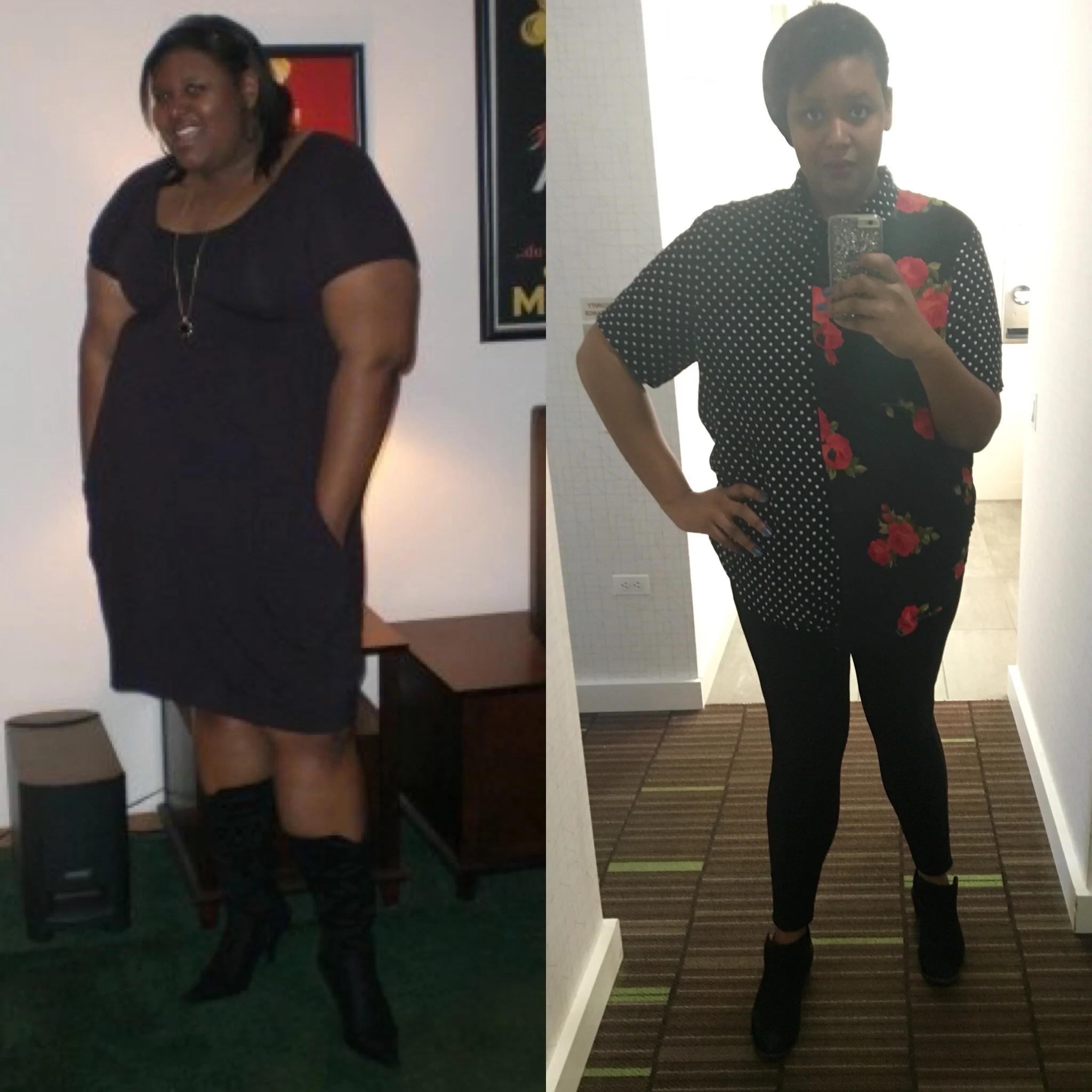 21 Weeks Post Op & 100 (+1) lbs Down