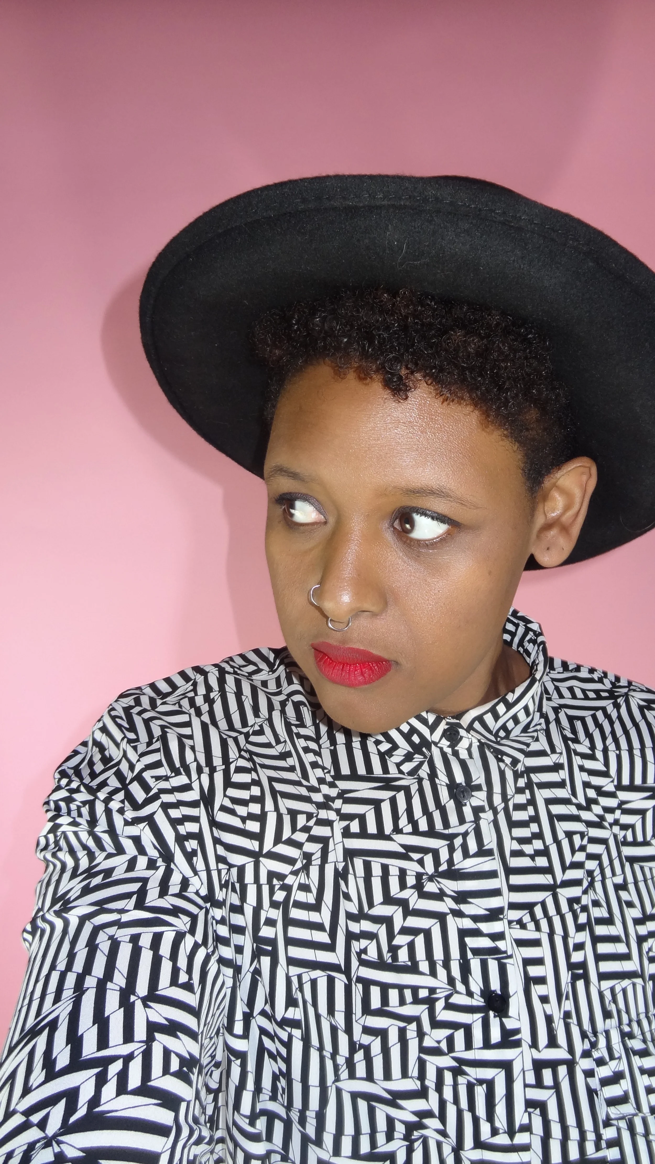 58-ish Weeks Post Op + 1 Year Post Op Pics