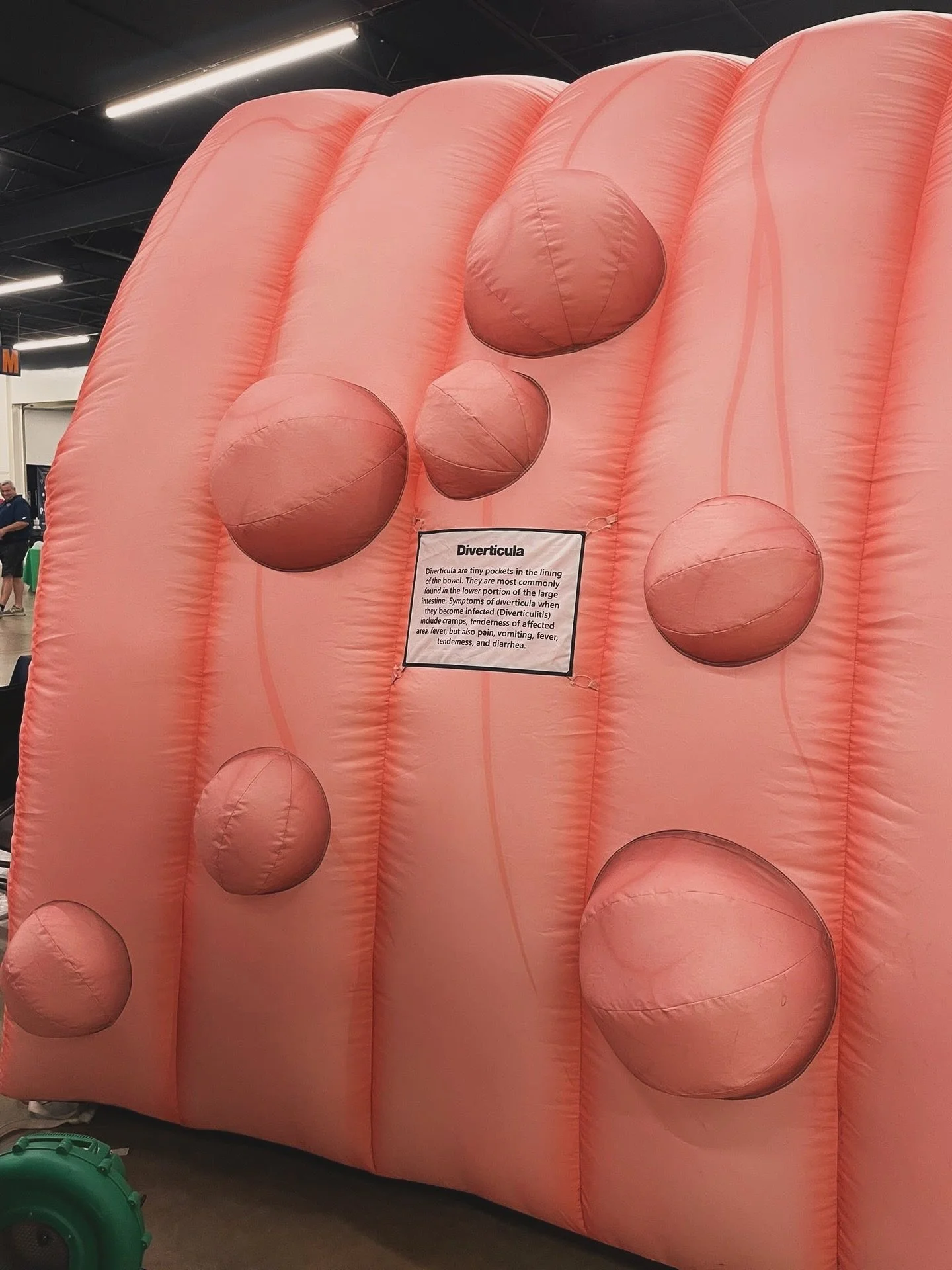 New things at the Arkansas State Fair: an inflatable colon with diverticulitis. Thanks for sharing @kdreep 

Hey everyone! Let&rsquo;s talk about diverticulitis! 🤔 

Diverticulitis happens when small pouches, called diverticula, form in the walls of