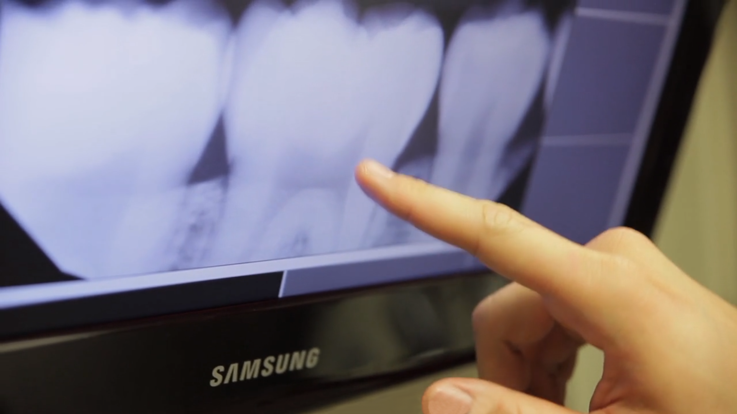 Doctor pointing at a digital x-ray