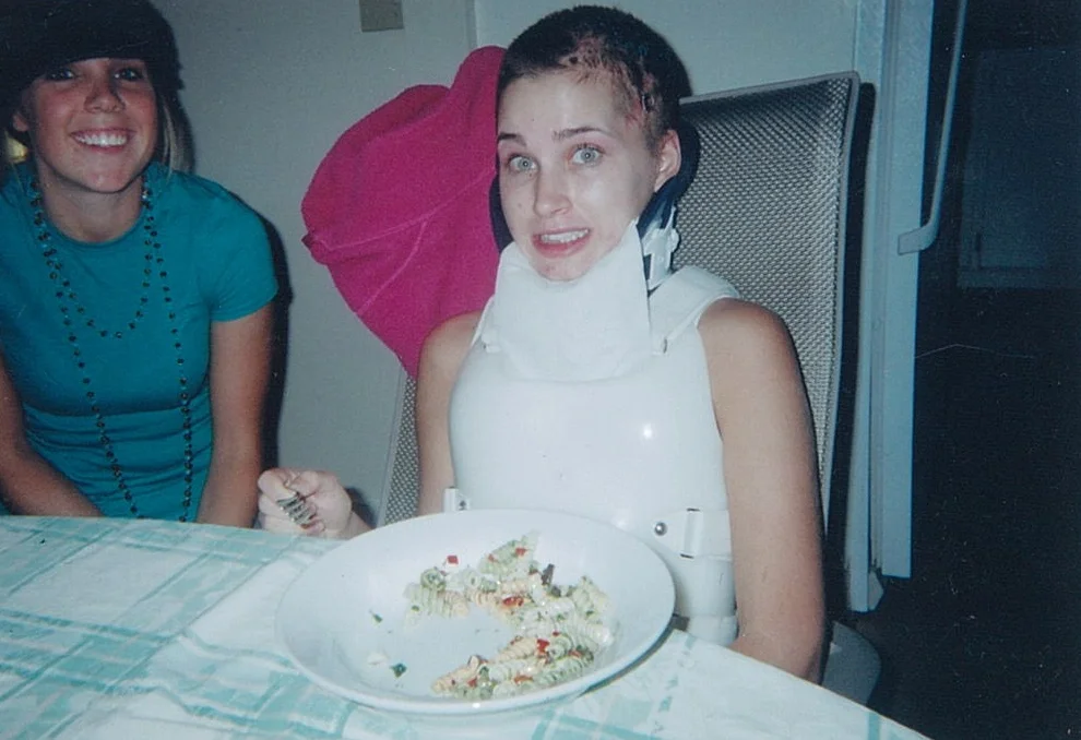 Me two months into  recovery at UW Medical Center.