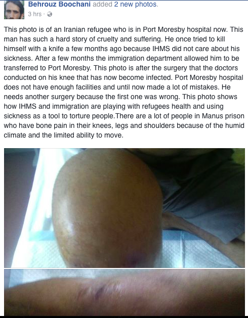 Posted on Facebook by Behrouz Boochani on Tuesday 29th November 2016