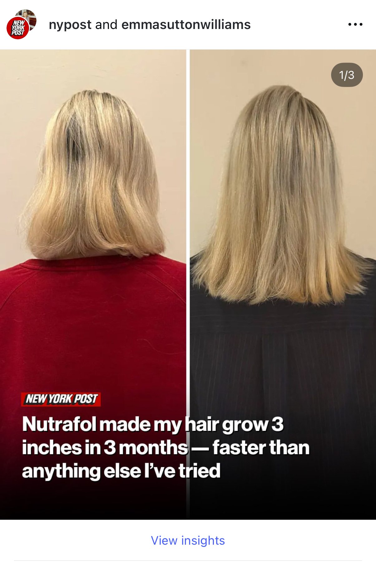 NY Post Nutrafol.jpg