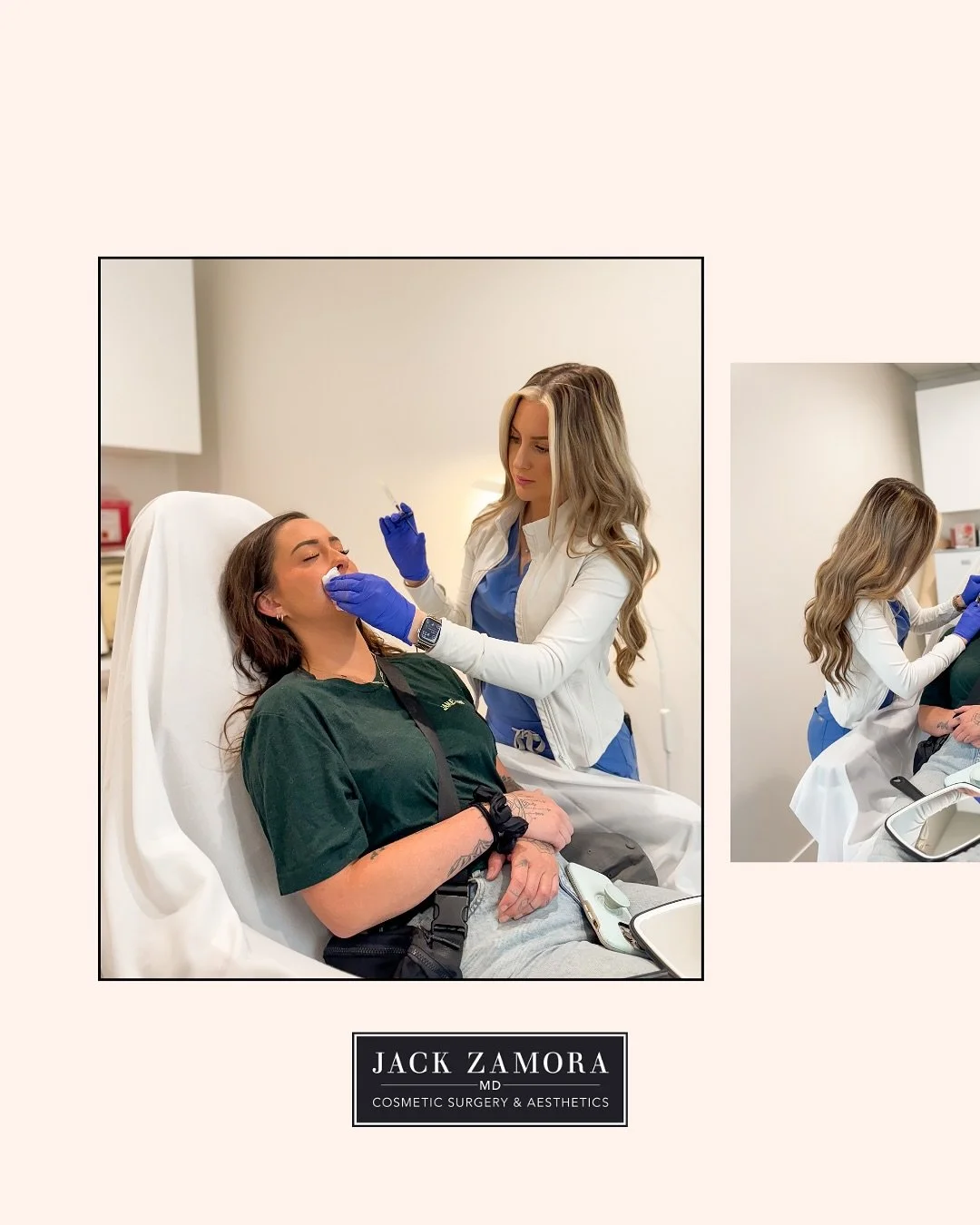 POV: You&rsquo;re in the chair&hellip; here&rsquo;s what happens next👄
The precision lip process: mapping, micro-droplet placement, and a focus on harmonious, hydrated lips. Because lip filler is more than volume. It&rsquo;s about balance, subtle en