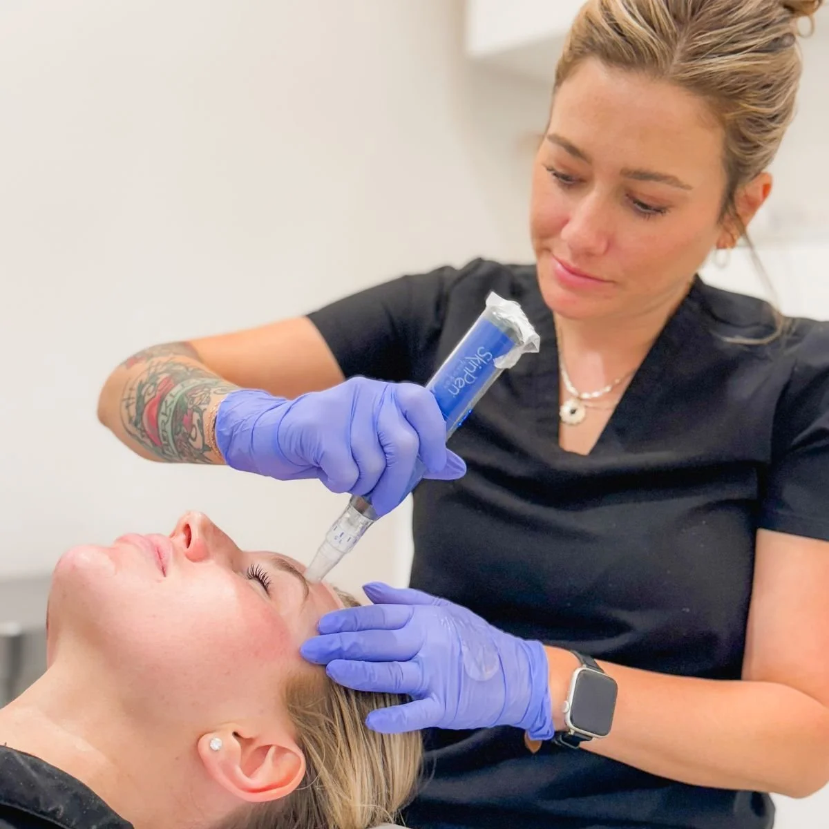 Microneedling Treatment