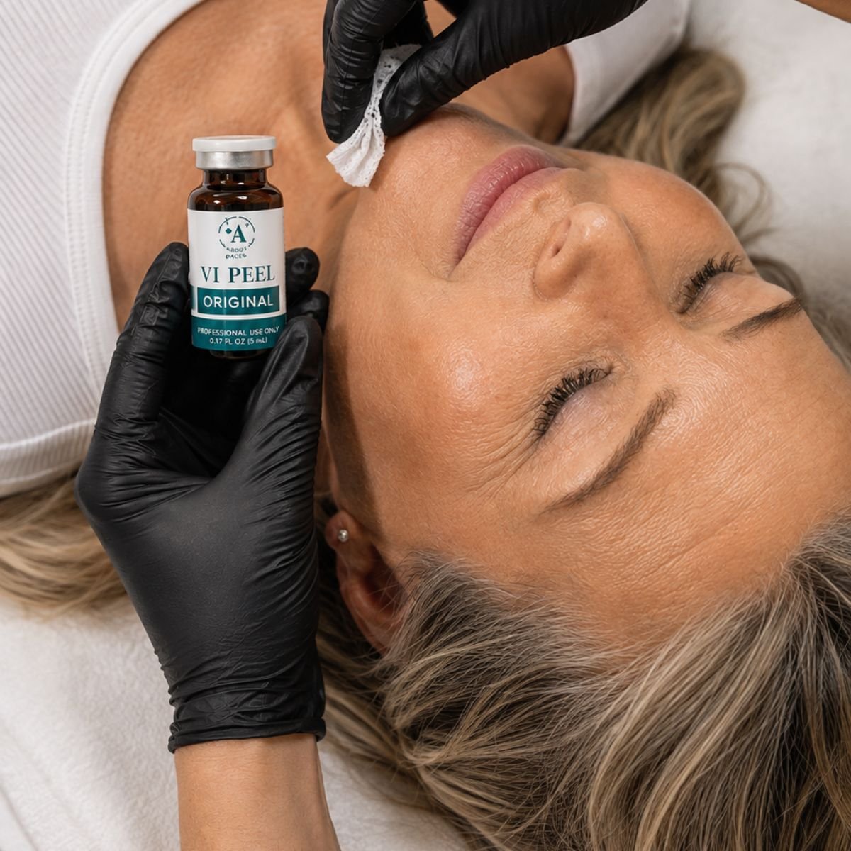 Woman receiving VI Peel Treatment
