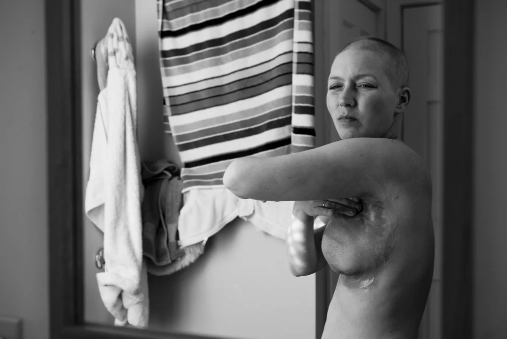 carcinoma_in_familia015.JPG