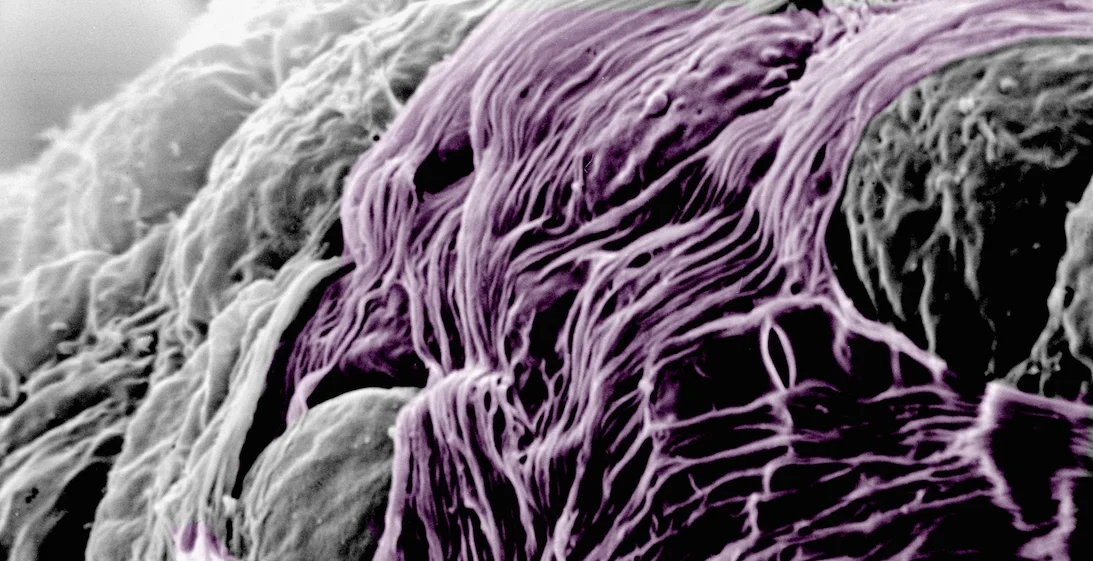 Differentiated embryonic stem cells.jpg