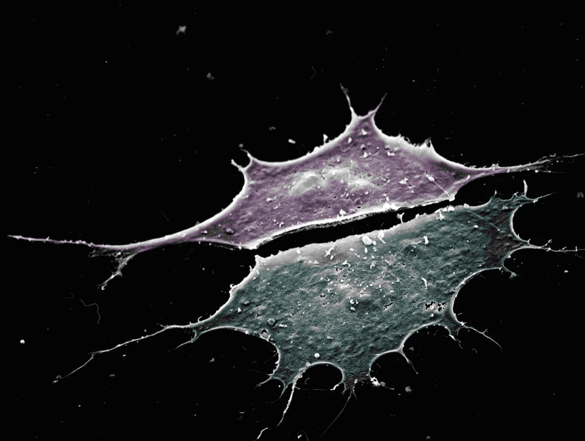 Mouse fibroblast cells.jpg