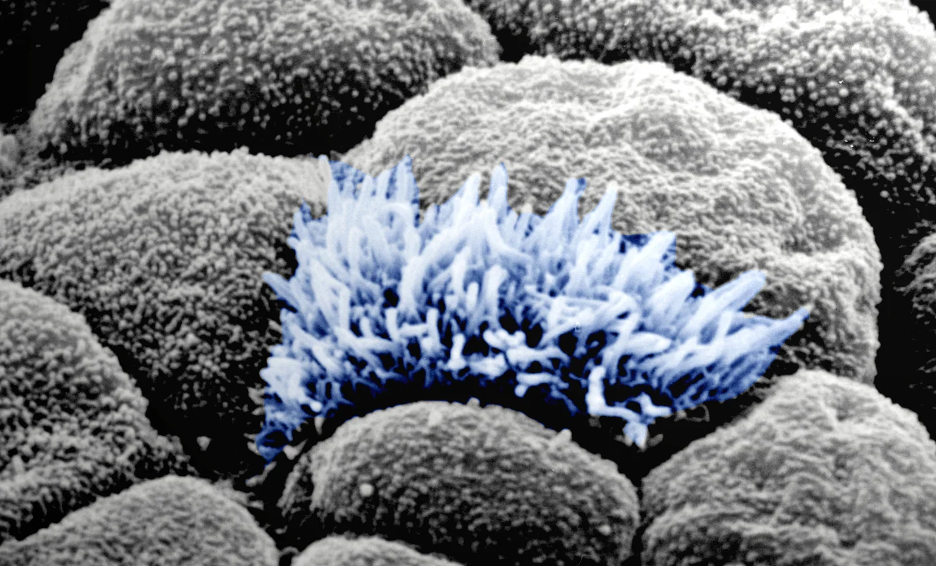 Differentiated embryonic stem cells into epithelium-like cells.jpg