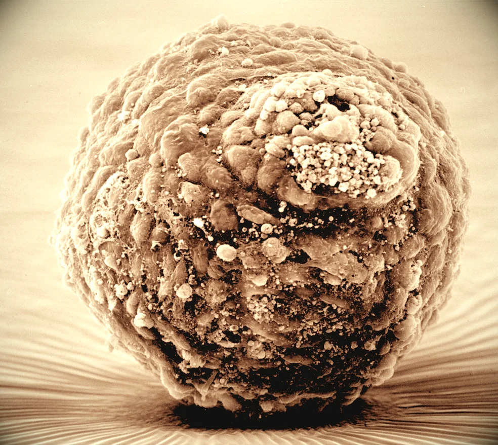 Differentiated mouse embryonic body.jpg