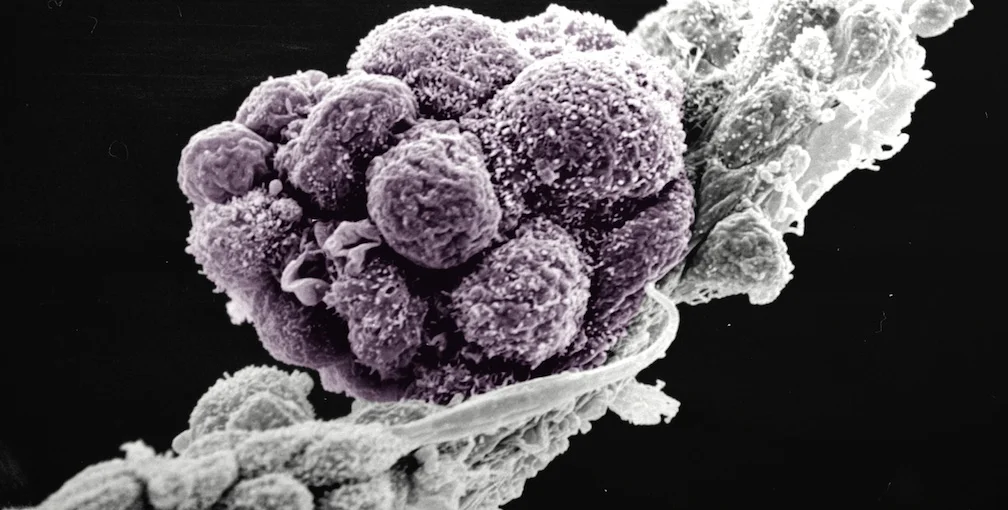 Germ cells derived from mouse embryonic stem cells.jpg