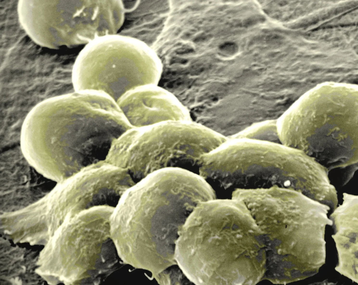 Mouse embryonic stem cells.jpg