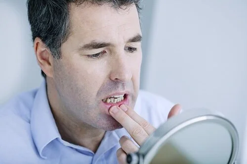 “Why Do My Gums Hurt?”