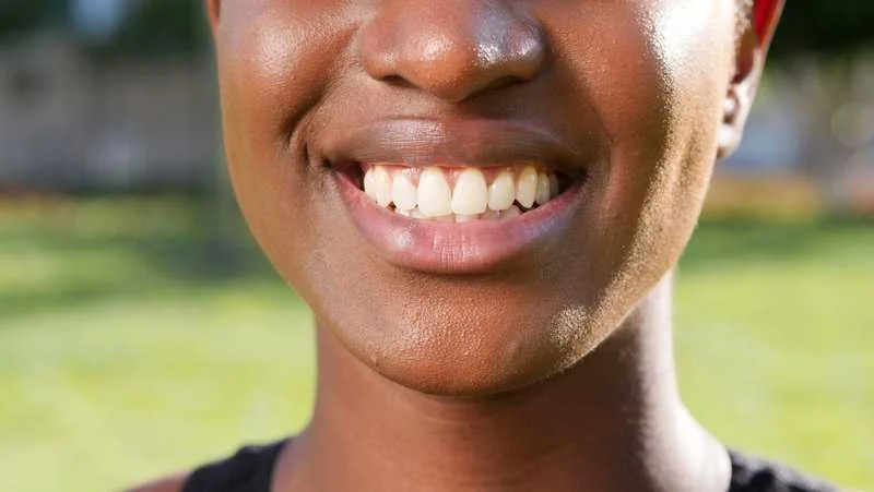 What Are The Risks of Whitening Strips?