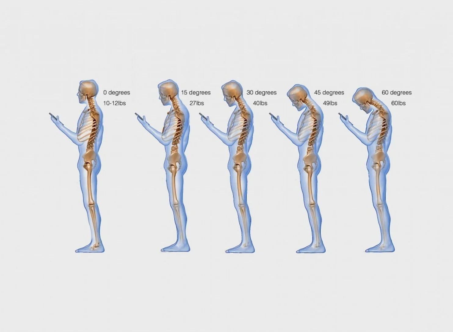 photo courtesy of Dr. Ken Hansraj, M.D., via the Washington Post