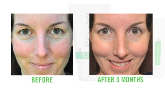 2013 MixedMediaMonster | "Rodan + Fields Transformative Results"