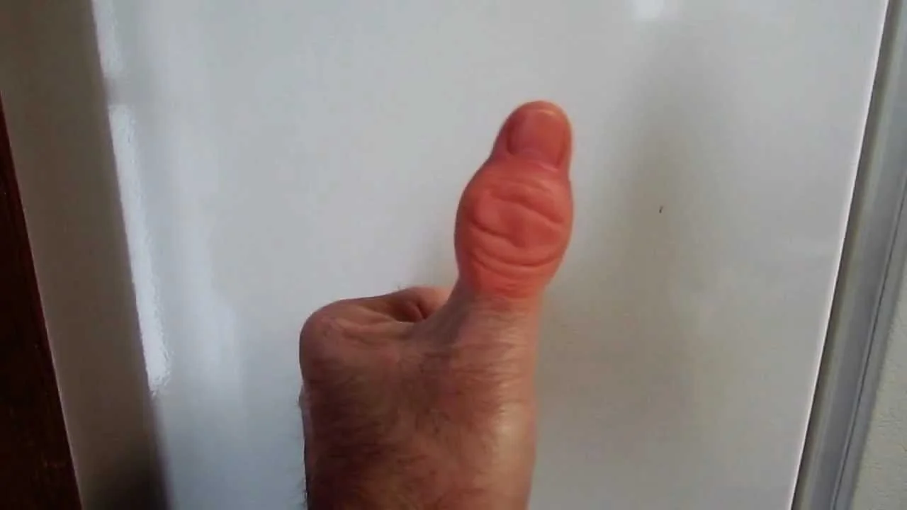 sore thumb 2.jpg
