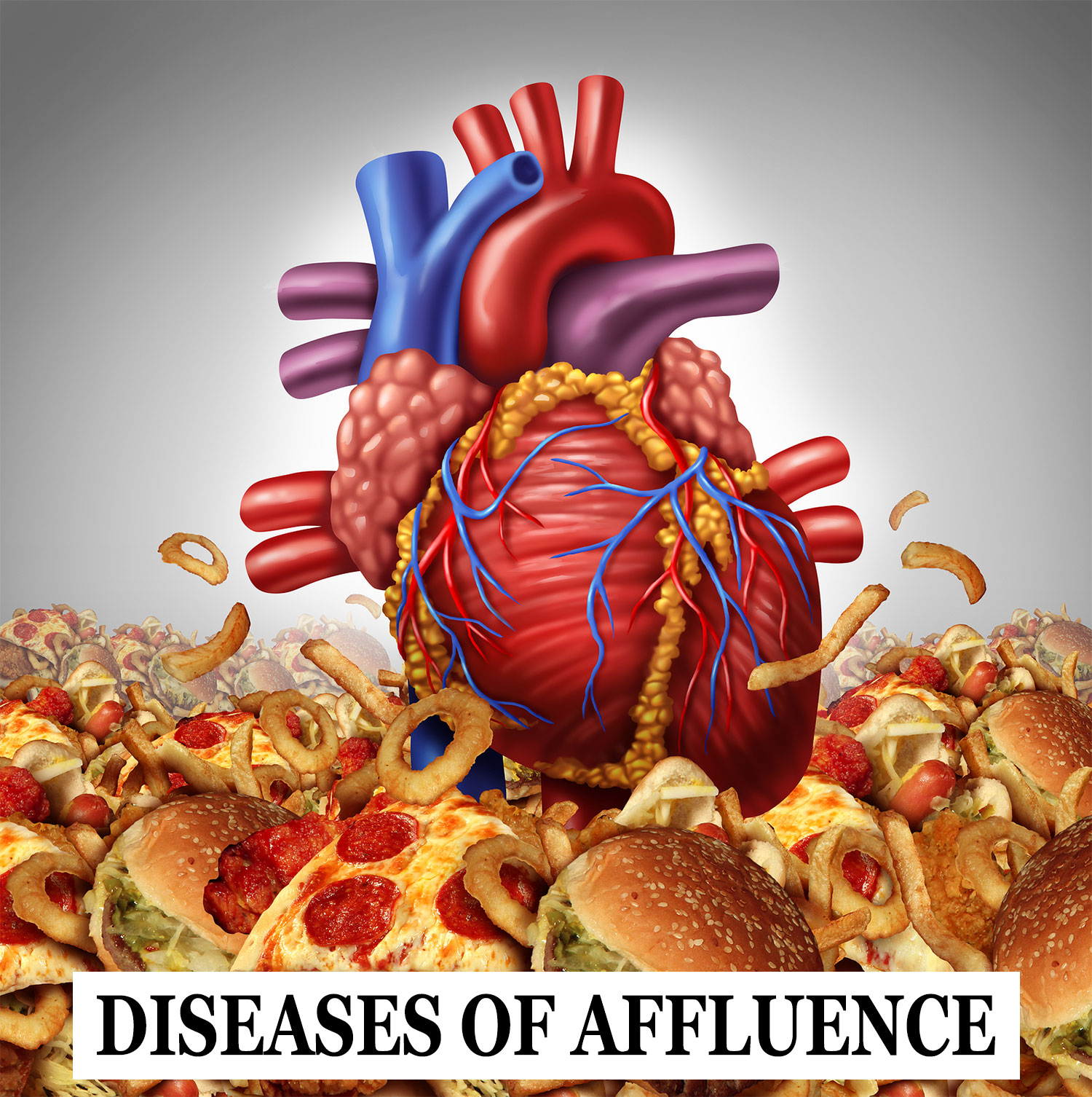 Disease of Affluence
