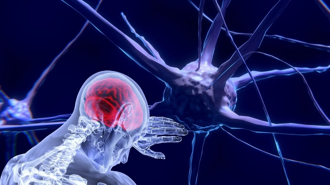 MS-neurons.jpg