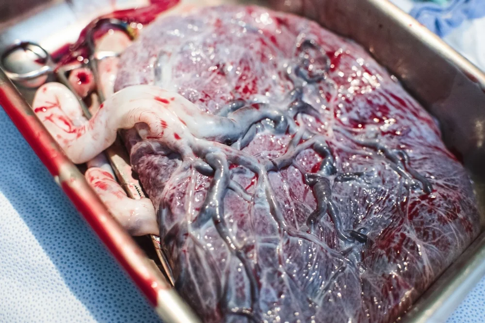 The Tree of Life comes from the way the veins branch out into the placenta.