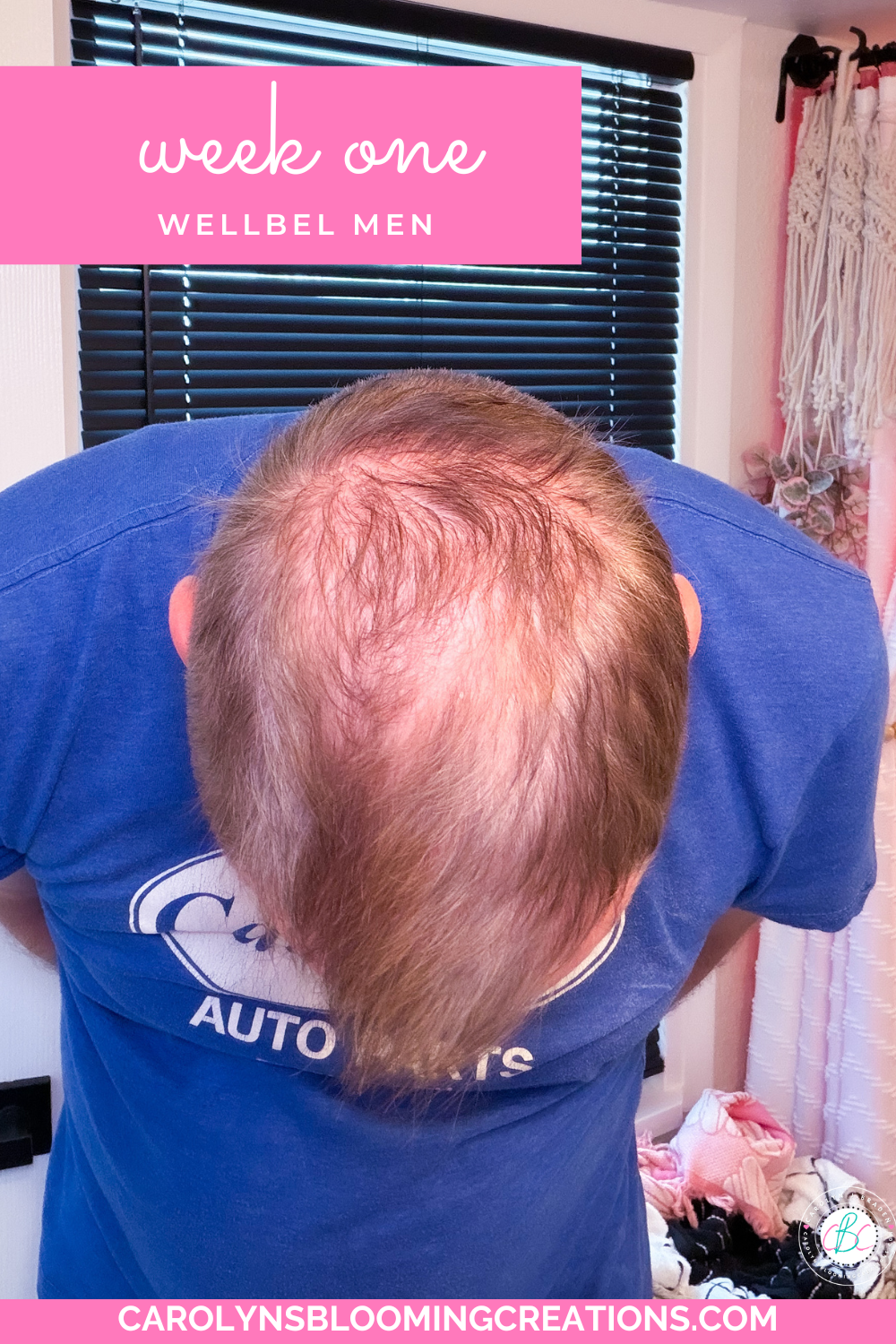 Problem Solution Girl Solves a Thinning Hairline