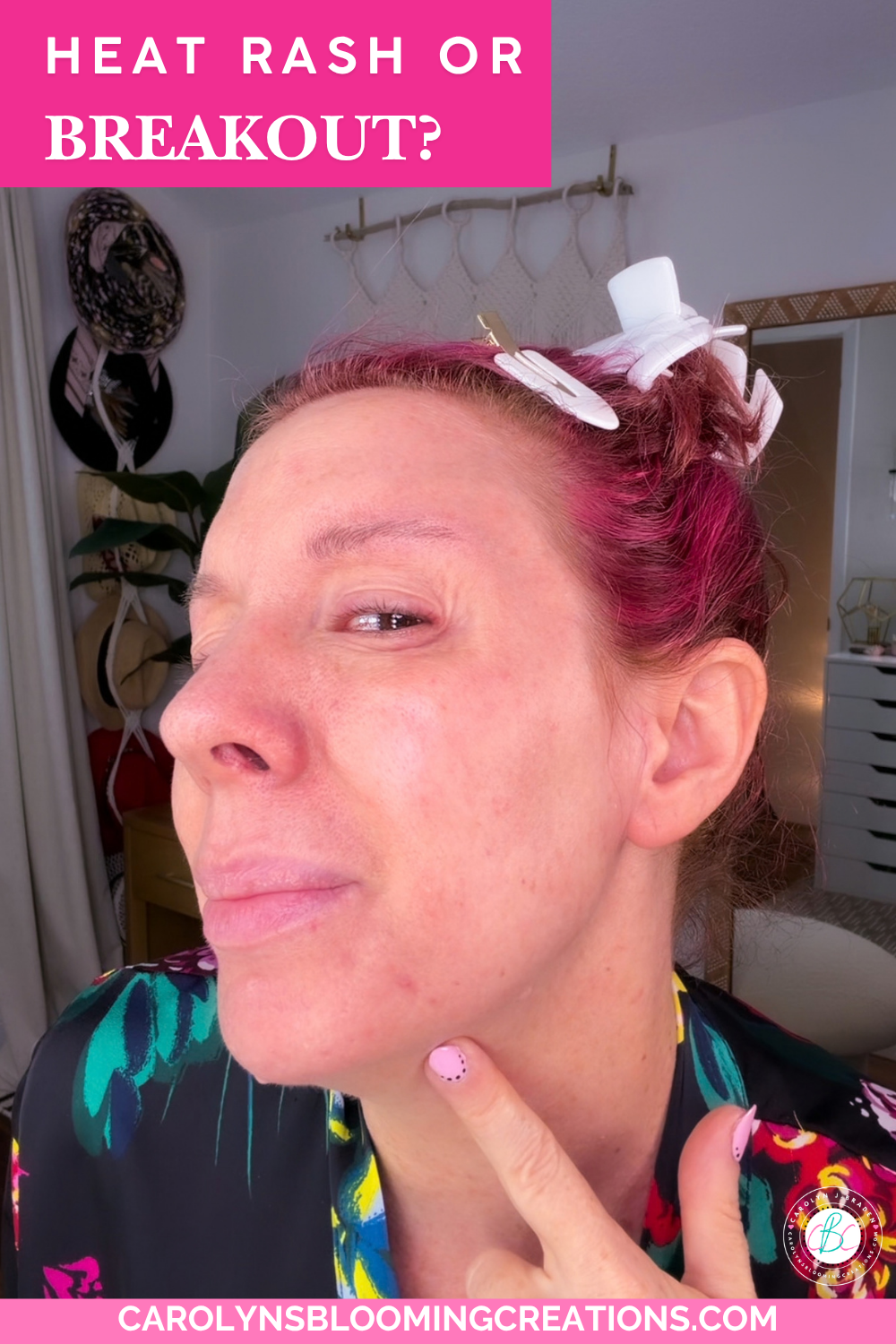 Facial Heat Rash: What Causes Those Tiny Bumps?