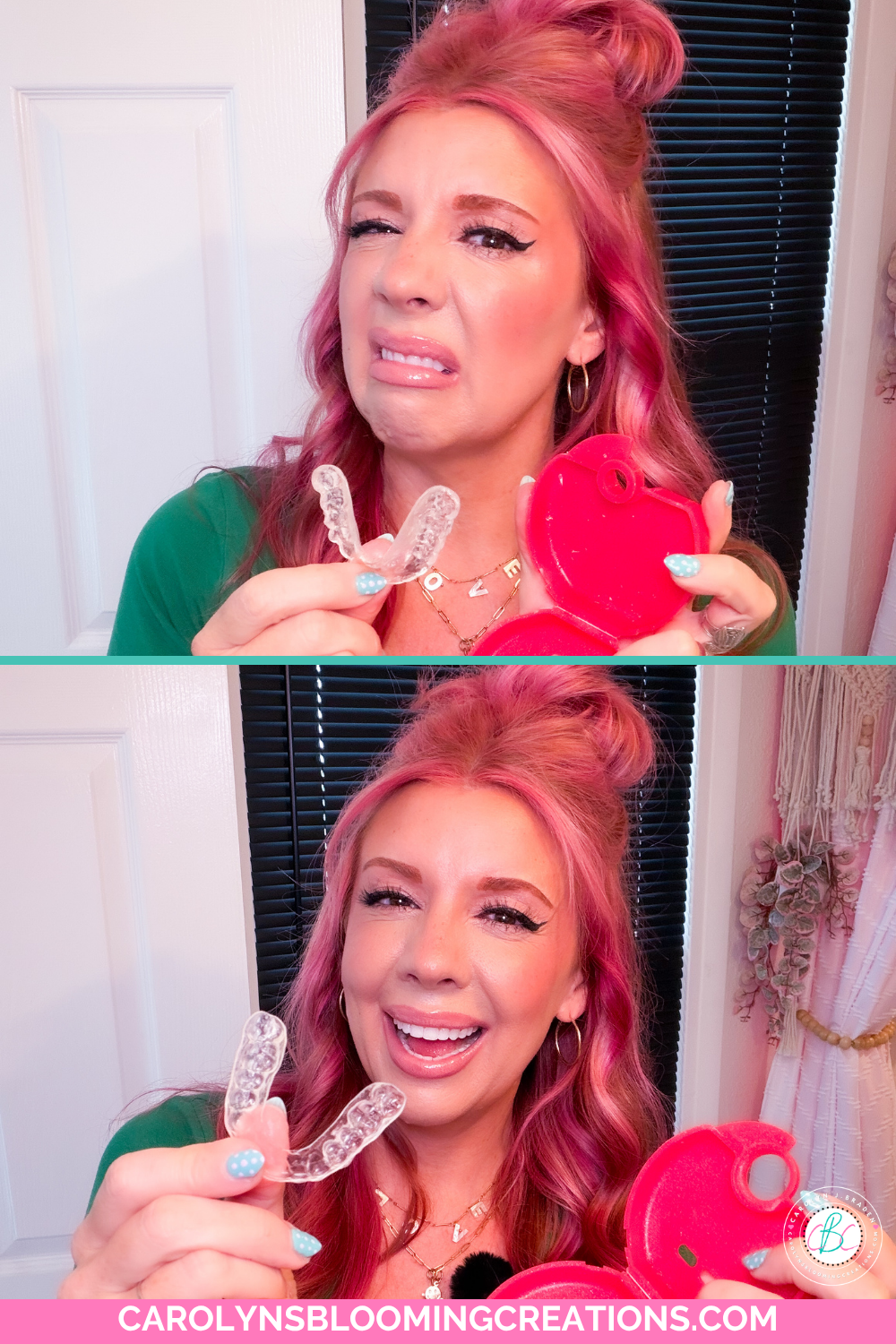 Carolyn Braden's DIY Retainer Cleaner That Removes White Calcium Buildup