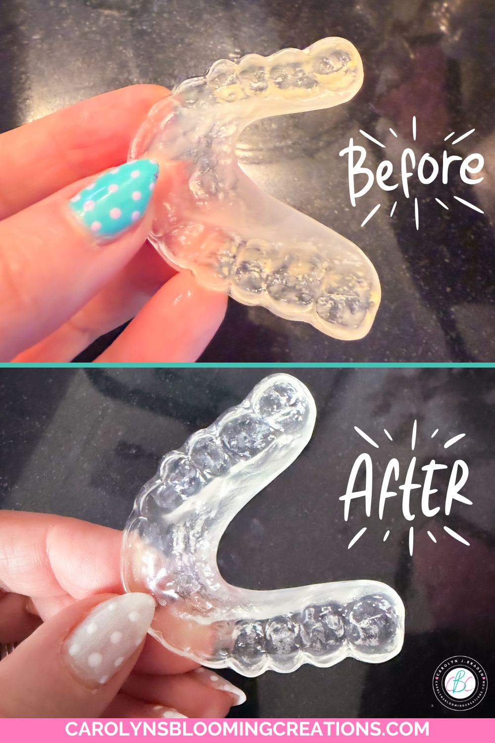 How to Deep Clean Your Retainers Using 3 Simple Ingredients