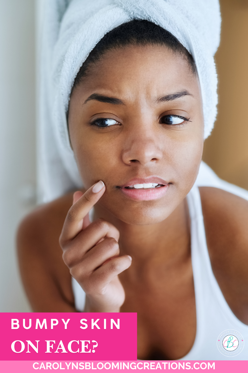 Heat Rash vs. Acne: How Can You Tell the Difference?