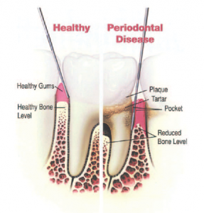 Healthy vs Diseased