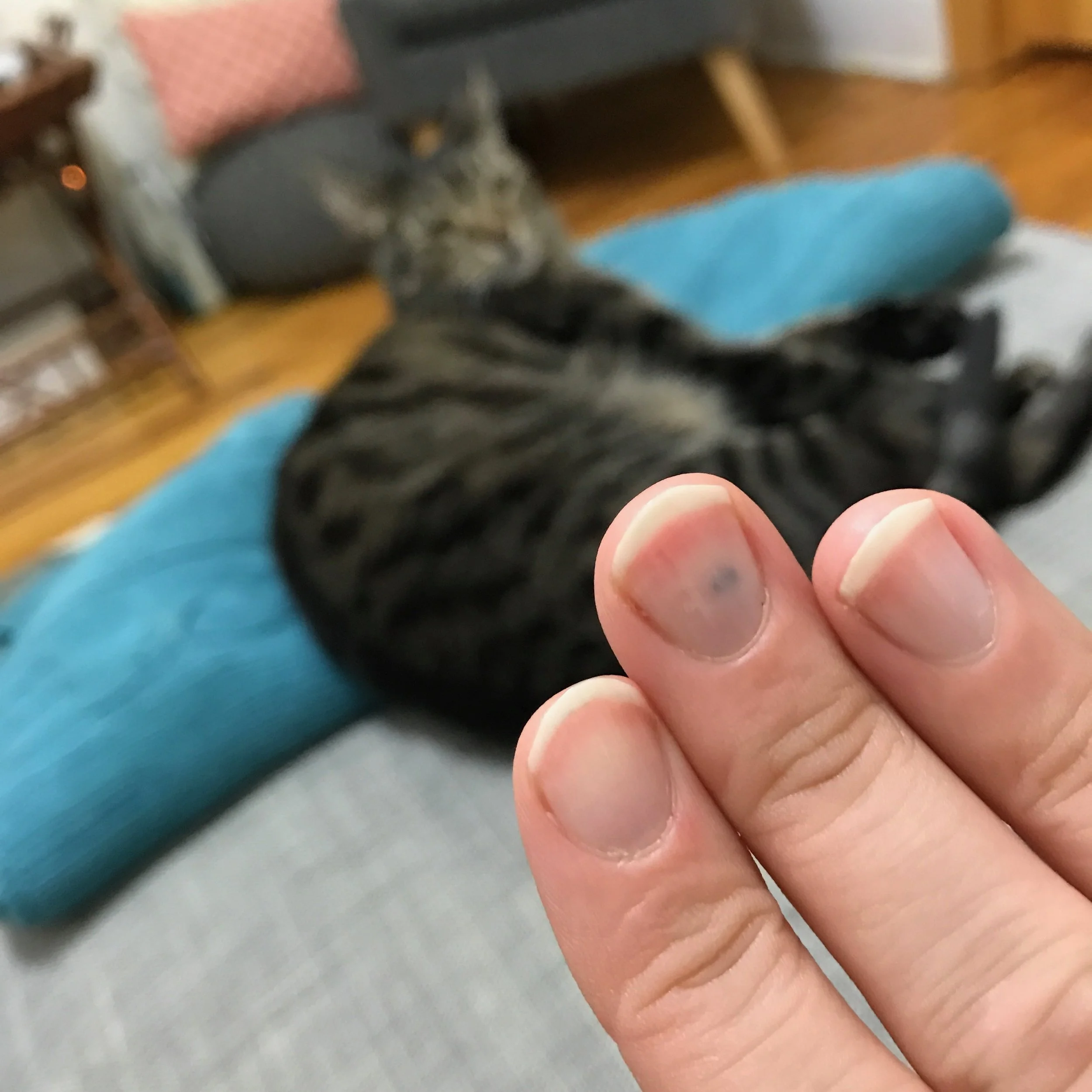 See how my middle finger is totally smashed?