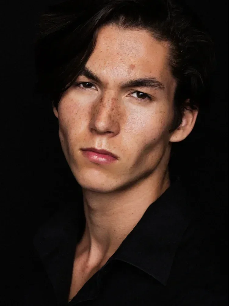 JORIN (now has shaved head)