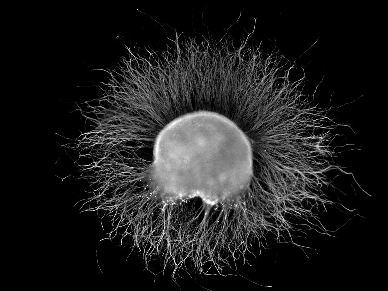 The halo of nerve growth that Rita saw looked something like this ( Photo via Wikimedia Commons ).