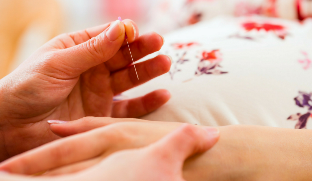 induction acupuncture.png