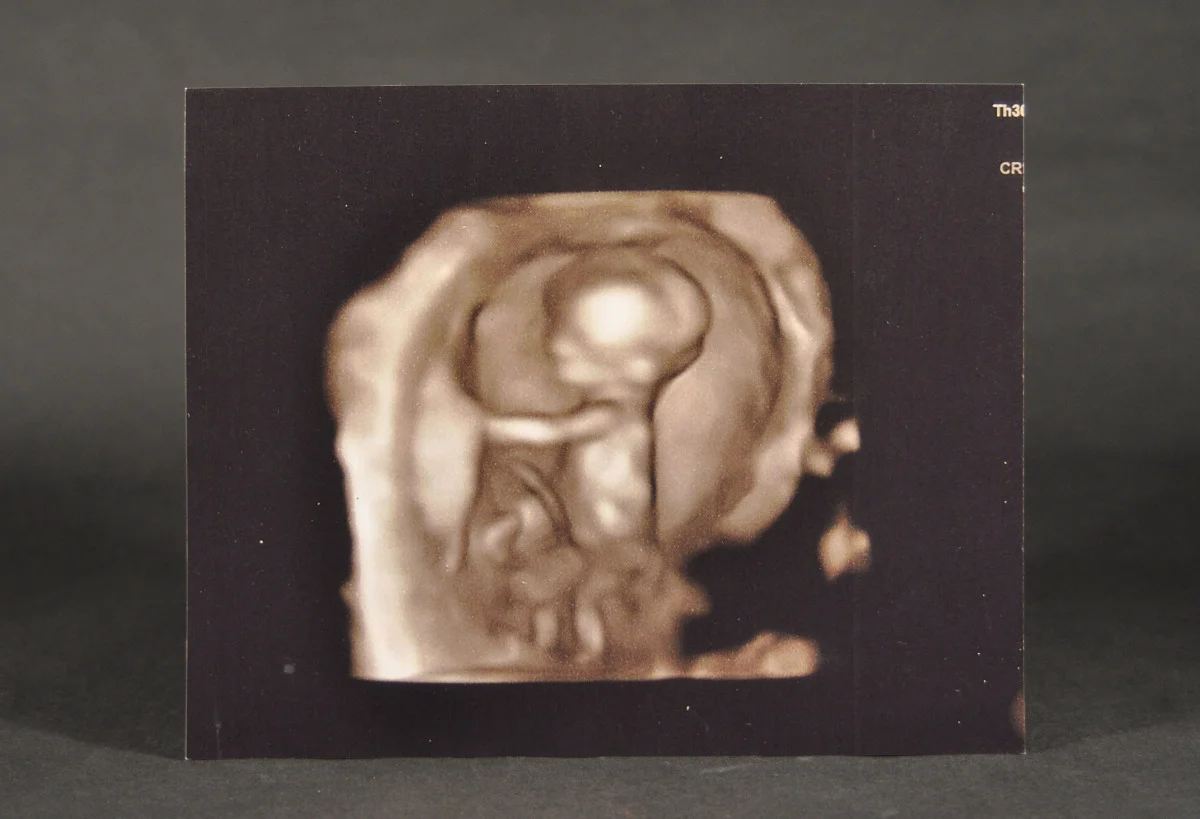 A photo of a positive ultrasound many years in the making representing physiological comfort.