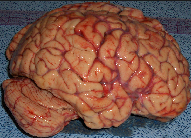 Not to gross you out, but does this look like a machine to you? This is what a brain looks like. 