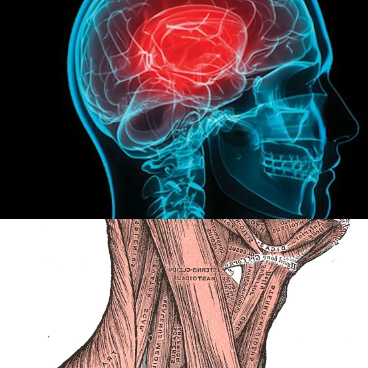 Neck Strength and Concussions
