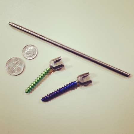Surgerical hardware after removal ( ed note: the coins are for reference)