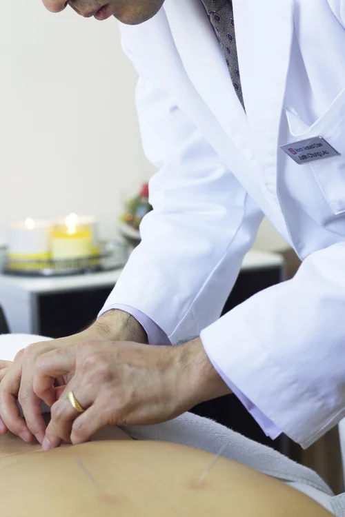 Acupuncture for neck and shoulder tension