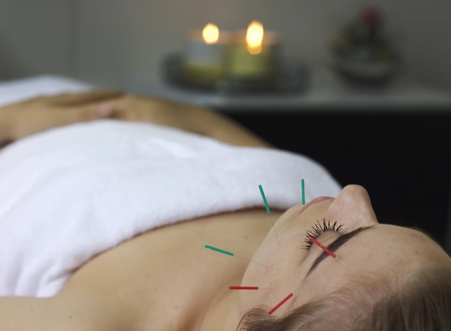 Cosmetic facial acupuncture treatment at Raah Acupuncture, Koreatown Los Angeles