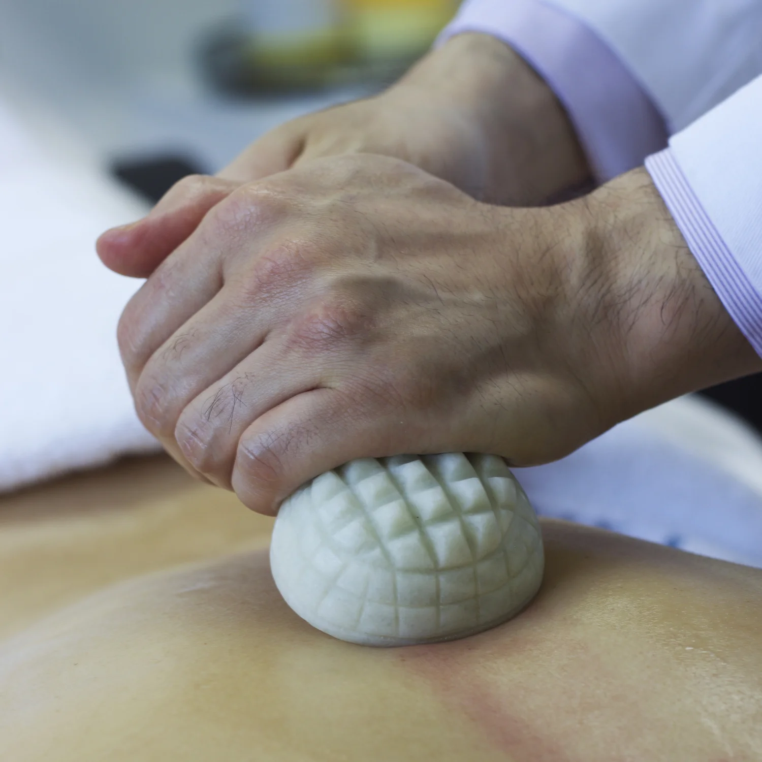Heated stone work on the back at Raah Acupuncture, Koreatown Los Angeles