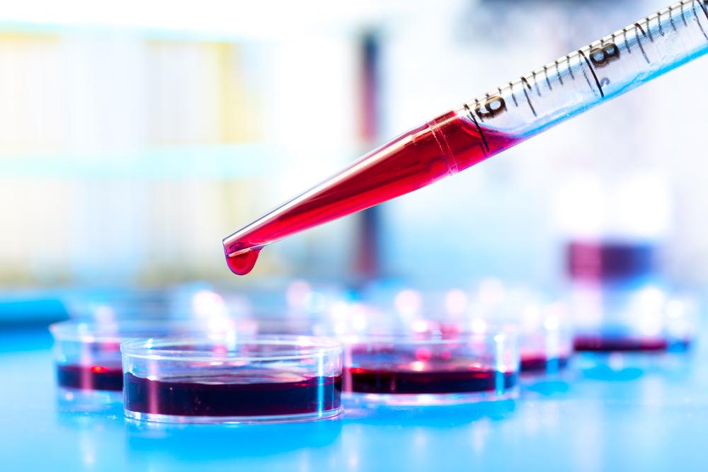 Blood tests can track a number of different markers which help indicate a tumor's growth Photo courtesy of www.digitaltrends.com
