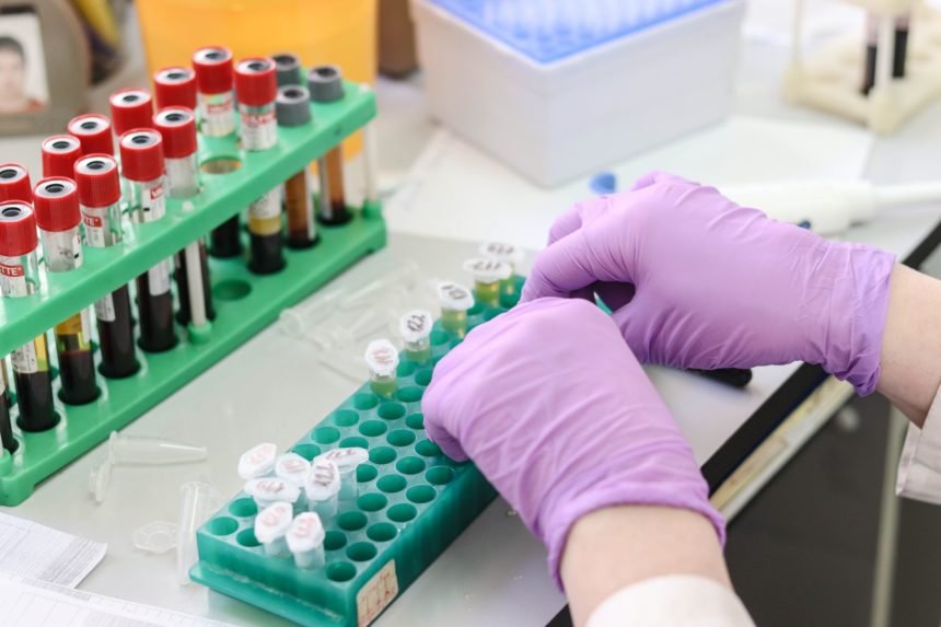 Una sperimentazione regala nuove speranze ai piccoli malati delle sindromi PROS